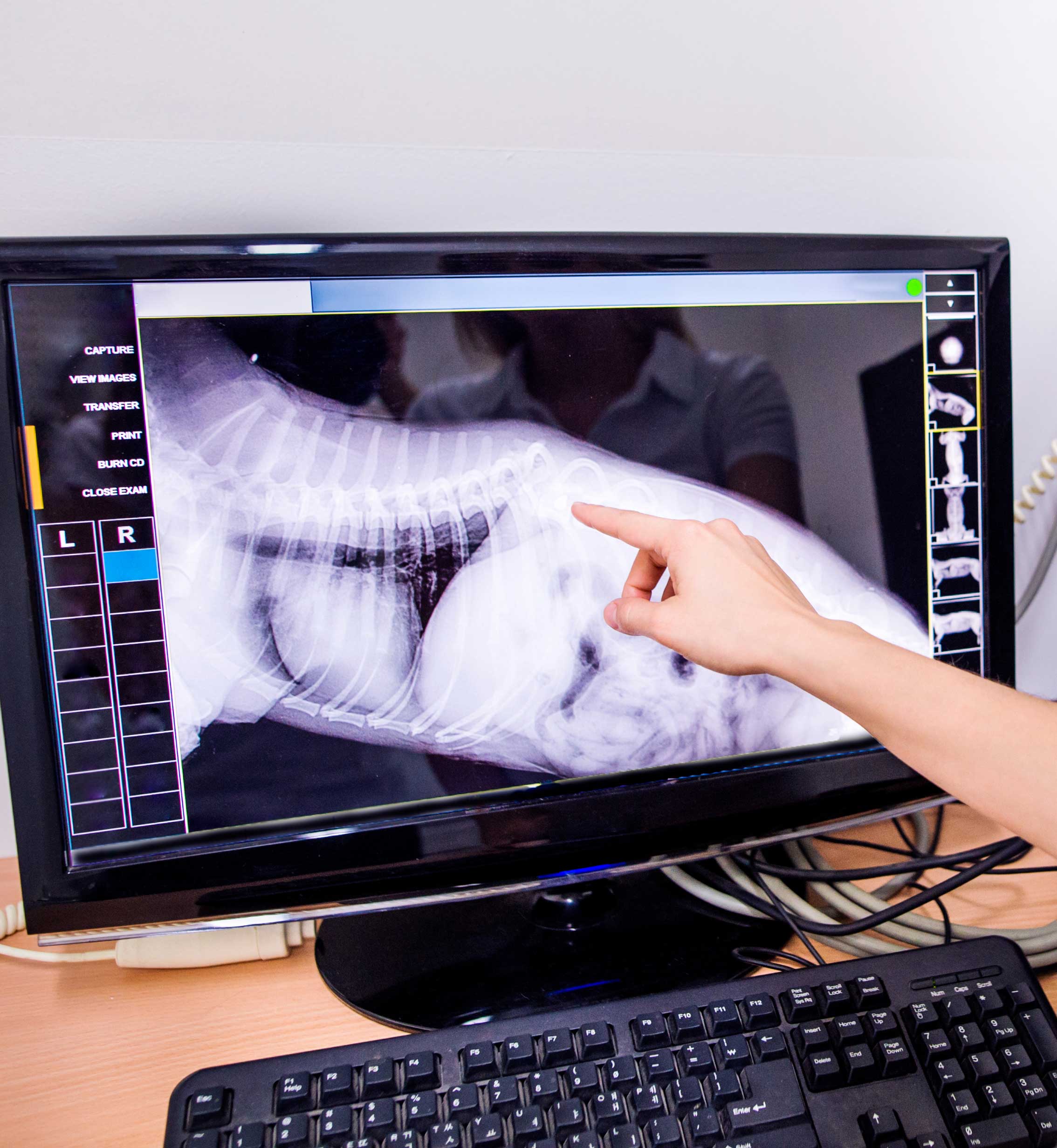 Digital X-Rays